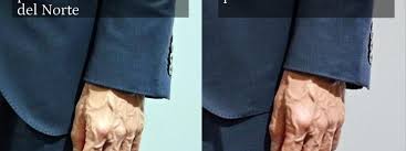La mano de Sánchez muestra inquietantes signos de vejez prematura, de estrés durísimo y de artrosis avanzada.