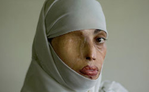 ¡Viva el alcalde de Antibes!