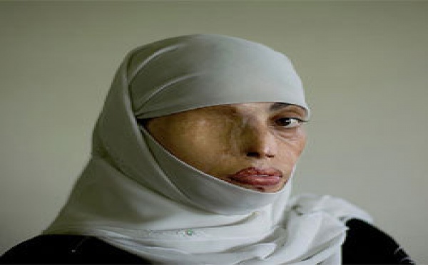 ¡Viva el alcalde de Antibes!